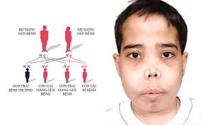 Tan máu bẩm sinh (thalassemia) là gì và những điều cần biết